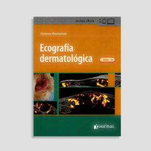 Ecografía Dermatológica