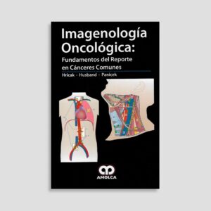 Imagenología Oncológica