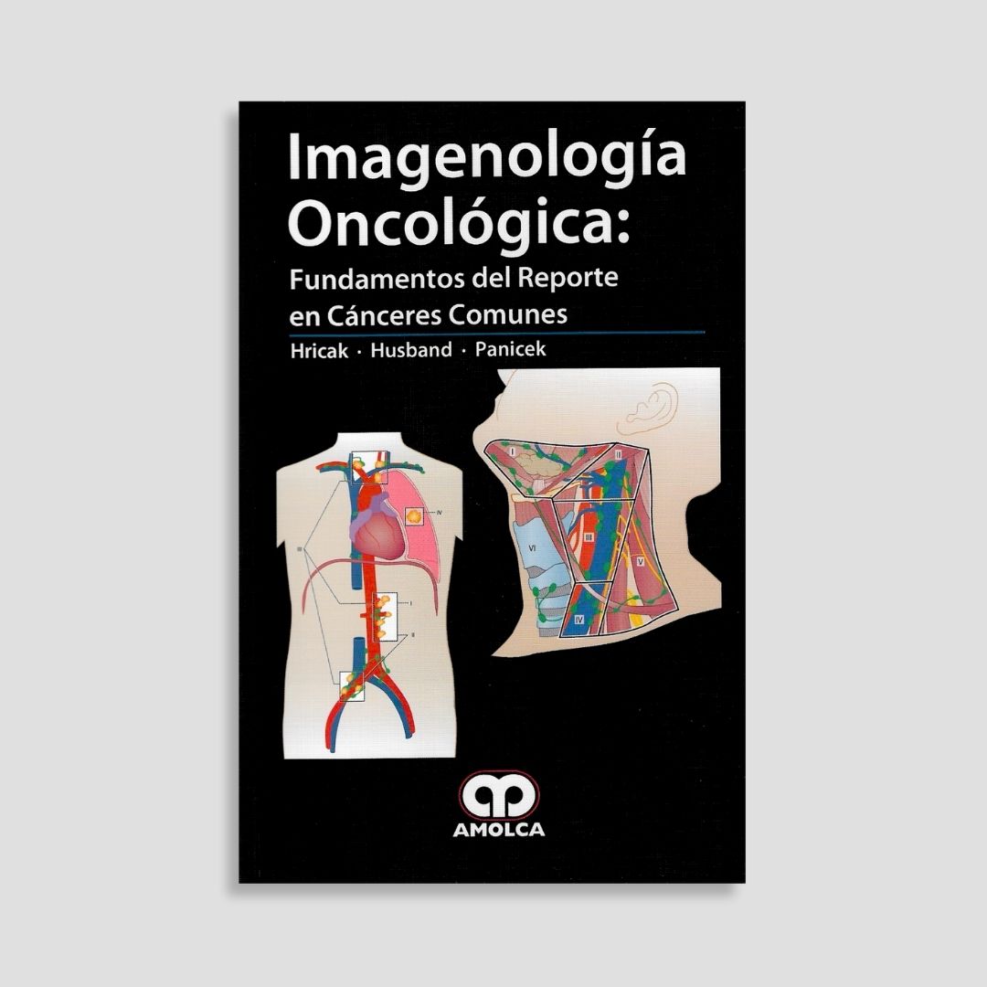 Imagenología Oncológica