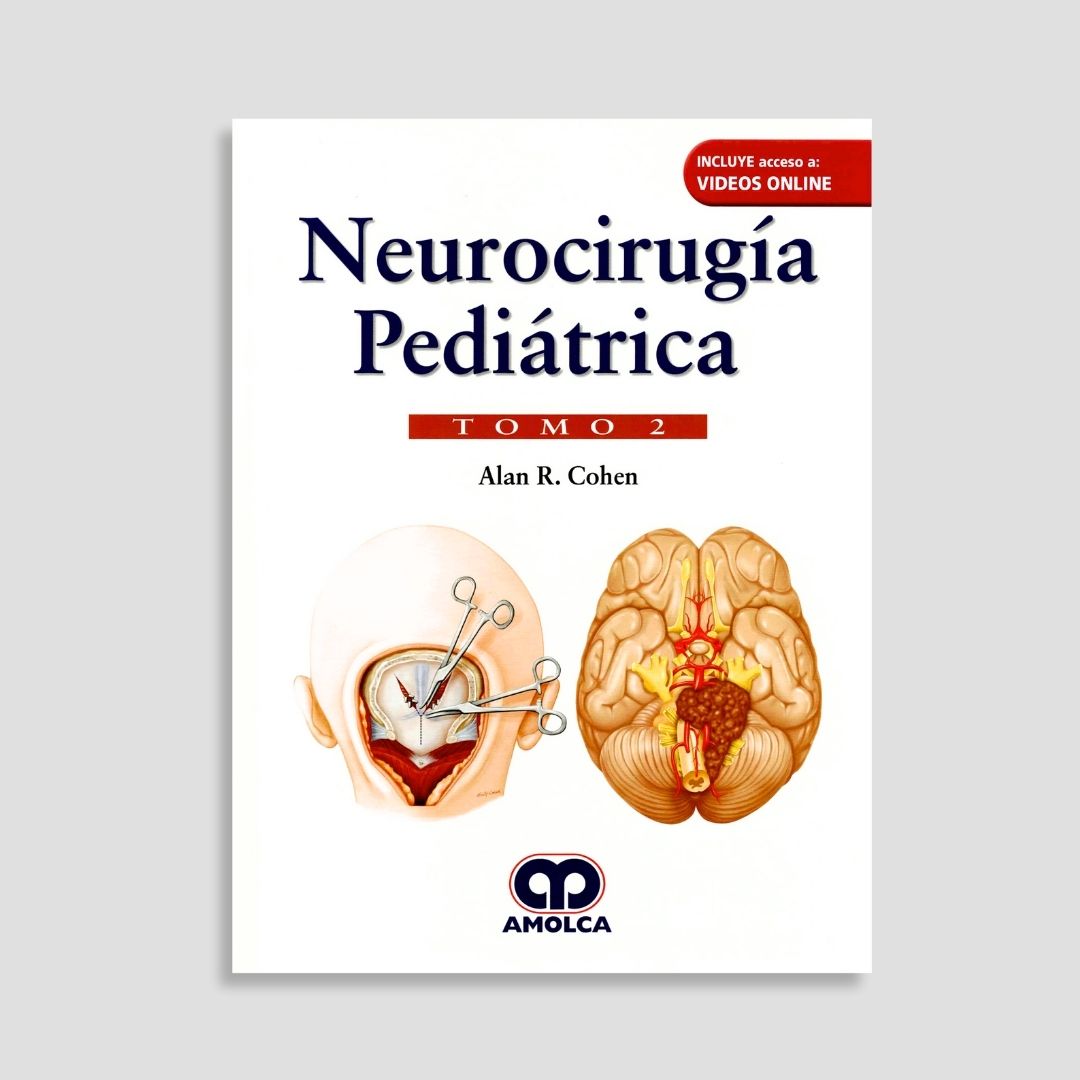 Neurocirugía Pediátrica - Image 4