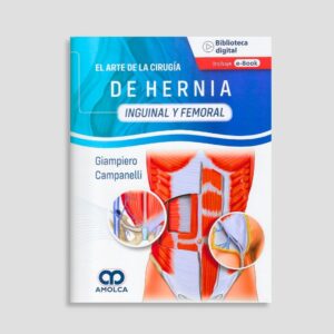 El arte de la cirugía de la hernia - Inguinal y Femoral