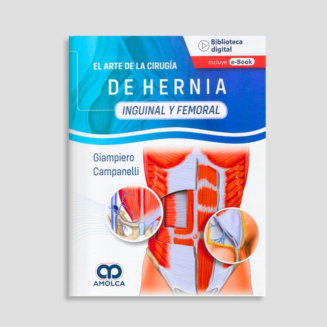 El arte de la cirugía de la hernia - Inguinal y Femoral