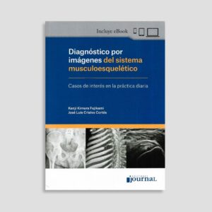 Diagnóstico por Imágenes del Sistema Musculoesquelético