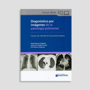 Diagnóstico por Imágenes de la Patología Pulmonar