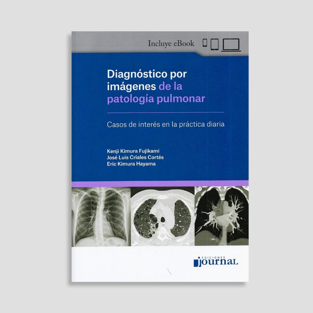Diagnóstico por Imágenes de la Patología Pulmonar