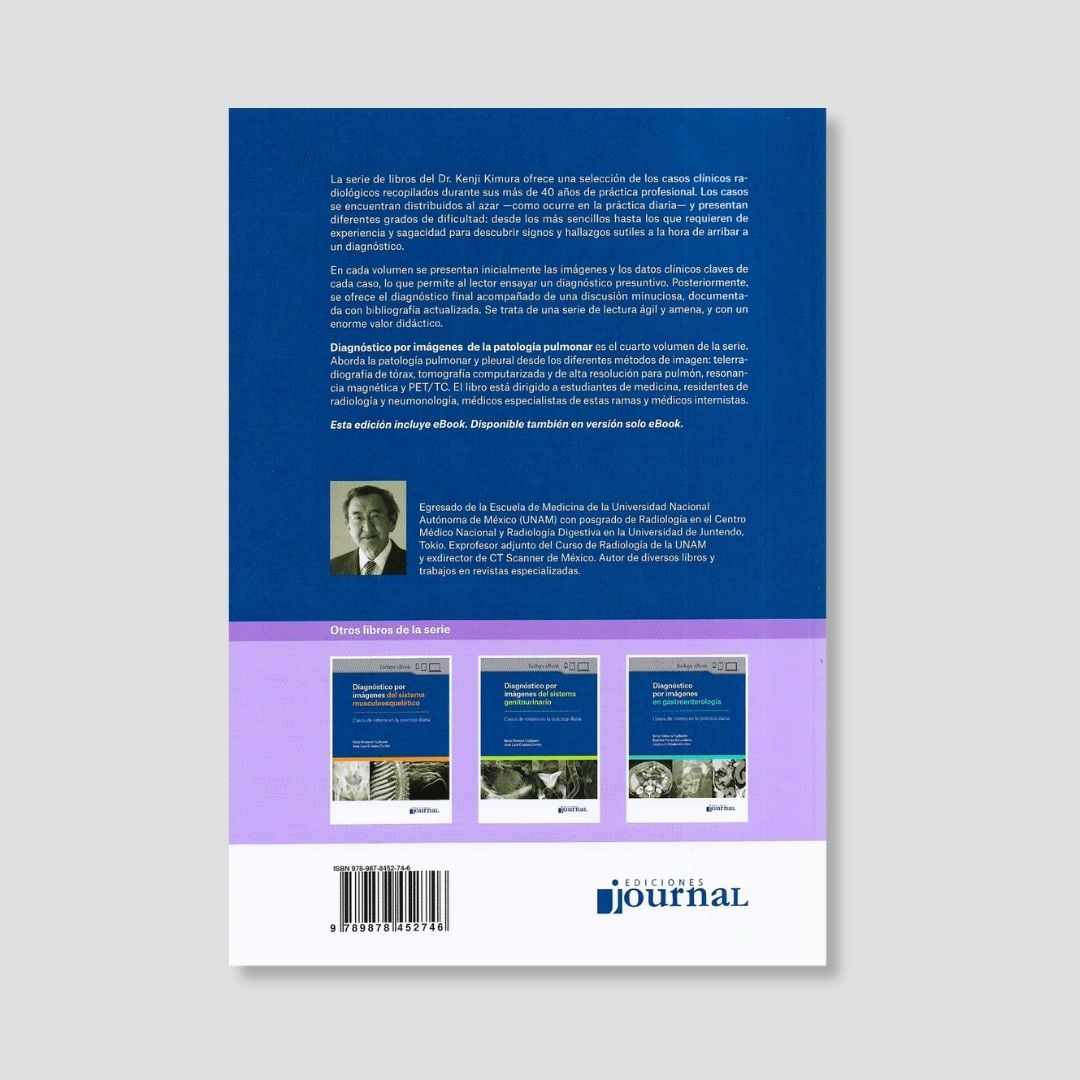 Diagnóstico por Imágenes de la Patología Pulmonar - Image 2