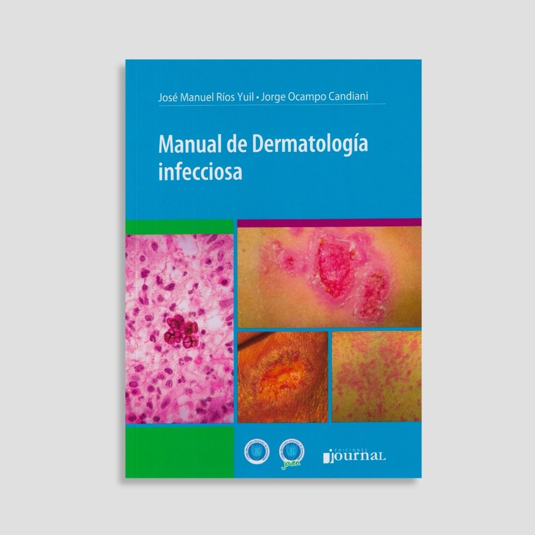 Manual De Dermatología Infecciosa