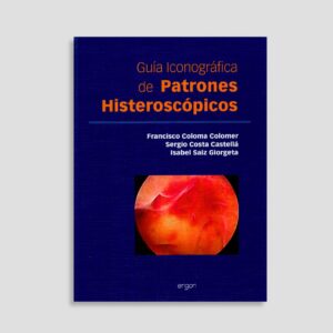 Guía iconográfica de patrones histeroscópicos