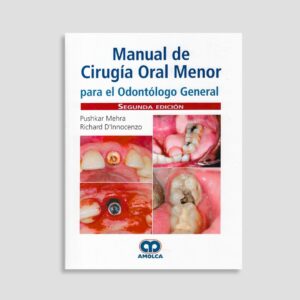 Manual de Cirugía Oral Menor para el Odontólogo General