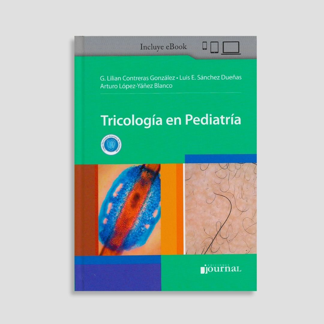 Tricología en Pediatría