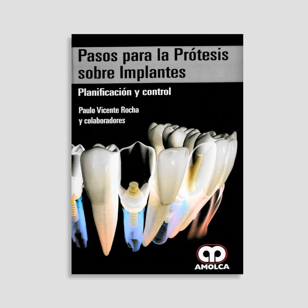 Pasos para la Prótesis Sobre Implantes
