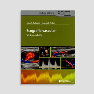 Ecografía Vascular