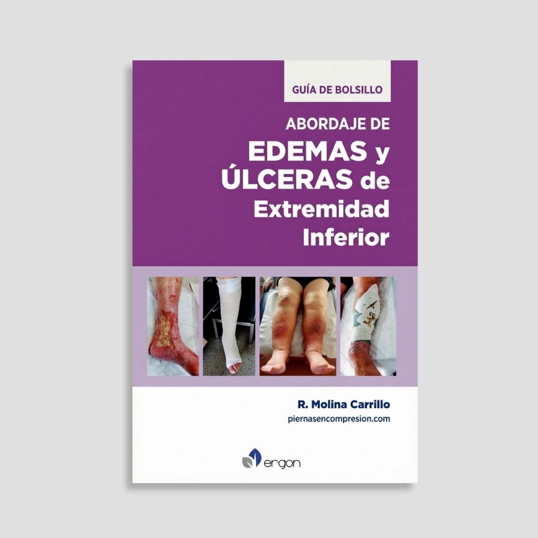 Abordaje de edemas y úlceras de extremidad inferior