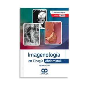 Imagenología en Cirugía Abdominal