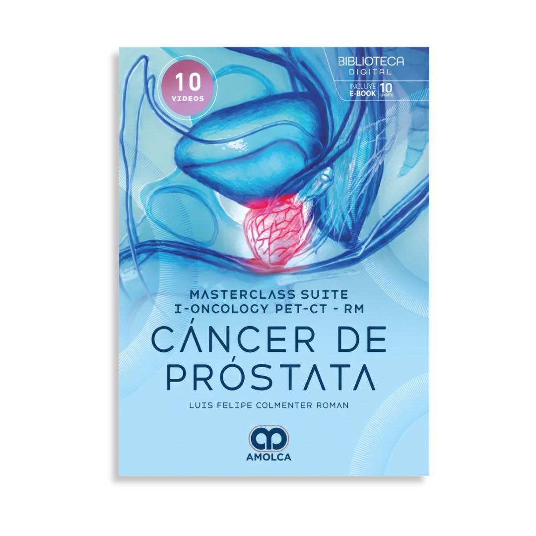 Cáncer de próstata