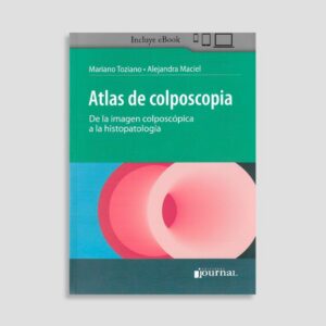 Atlas de Colposcopia