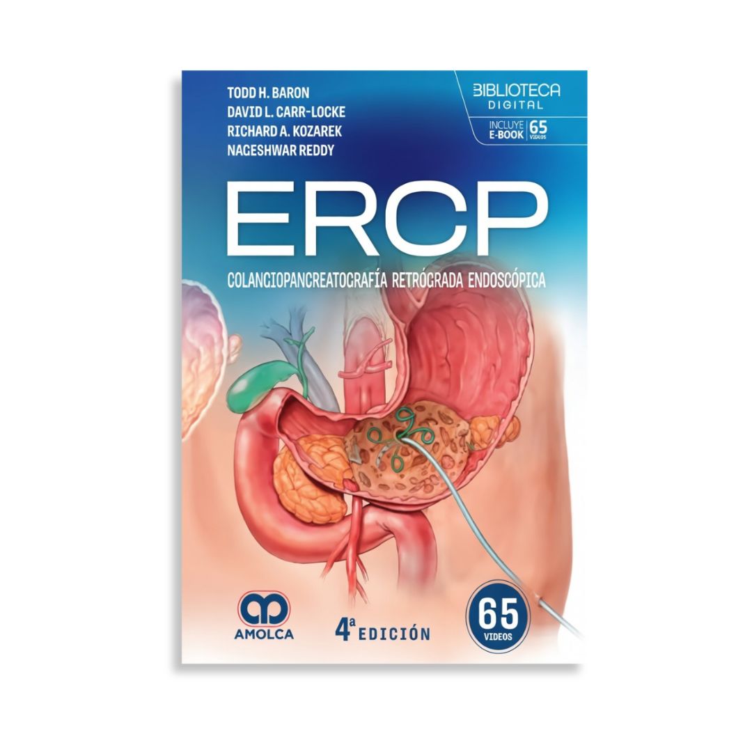 ERCP. Colangiopancreatografía retrógrada endoscópica