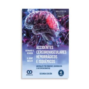 Accidentes cerebrovasculares hemorrágicos e isquémicos