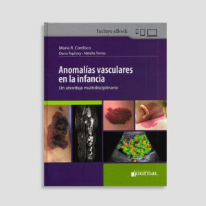 Anomalías Vasculares en la Infancia