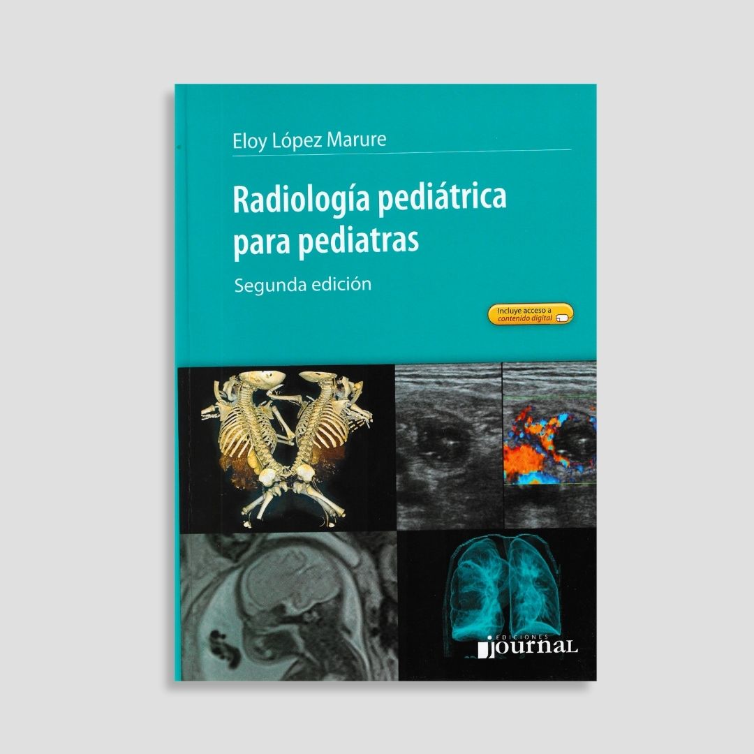 Radiología Pediátrica para Pediatras