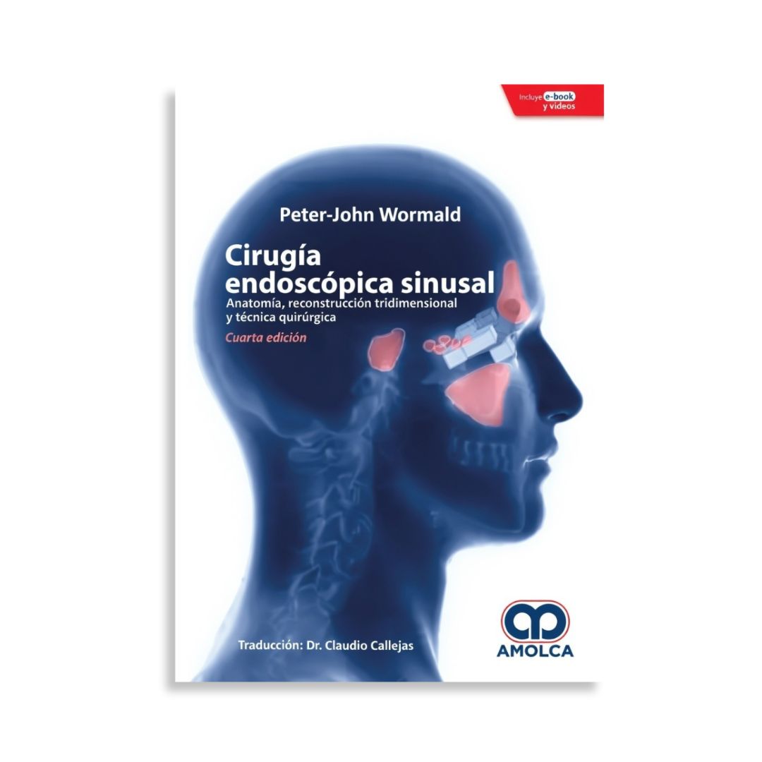 Cirugía Endoscópica Sinusal