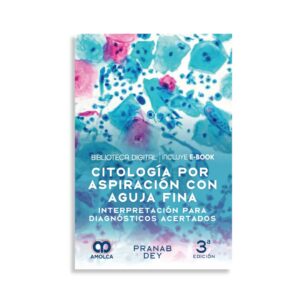 Citología por aspiración con aguja fina