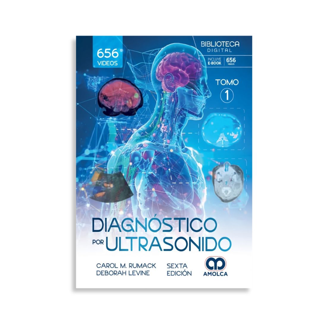 Diagnóstico por ultrasonido