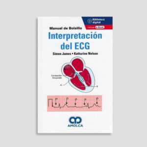 Interpretación del ECG