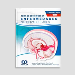Toma de Decisiones en Enfermedades Neurovasculares