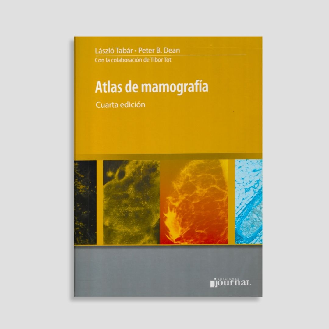 Atlas de Mamografía