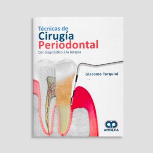 Técnicas de Cirugía Periodontal del Diagnóstico a la Terapia