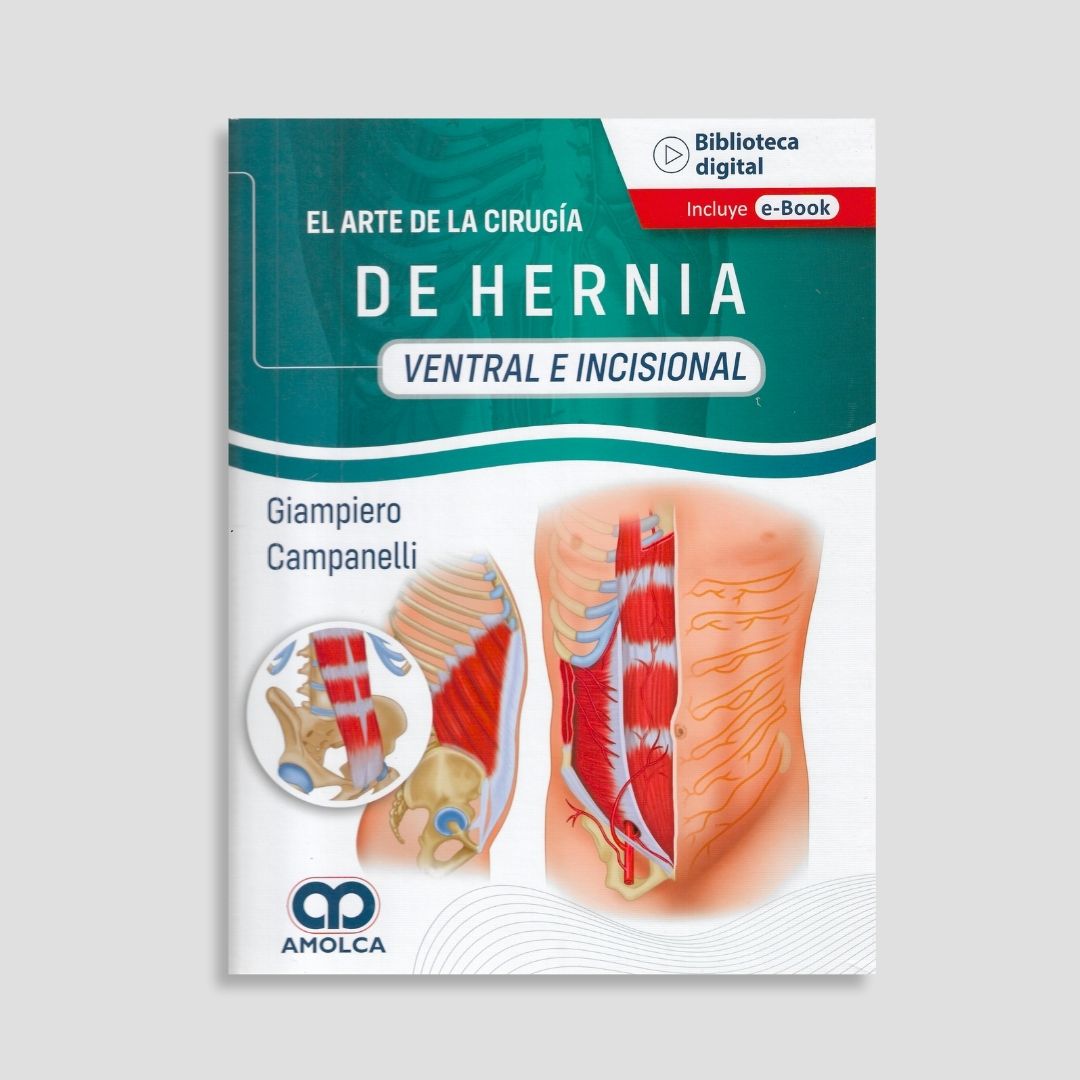 El arte de la Cirugía de la Hernia - Ventral e Incisional