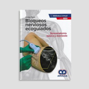 Bloqueos Nerviosos Ecoguiados
