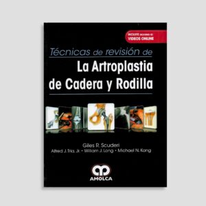 La Artroplastia de Cadera y Rodilla
