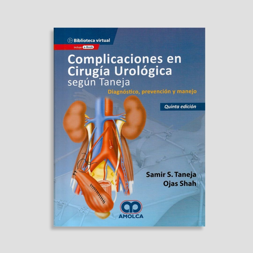 Complicaciones en Cirugía Urológica Según Taneja