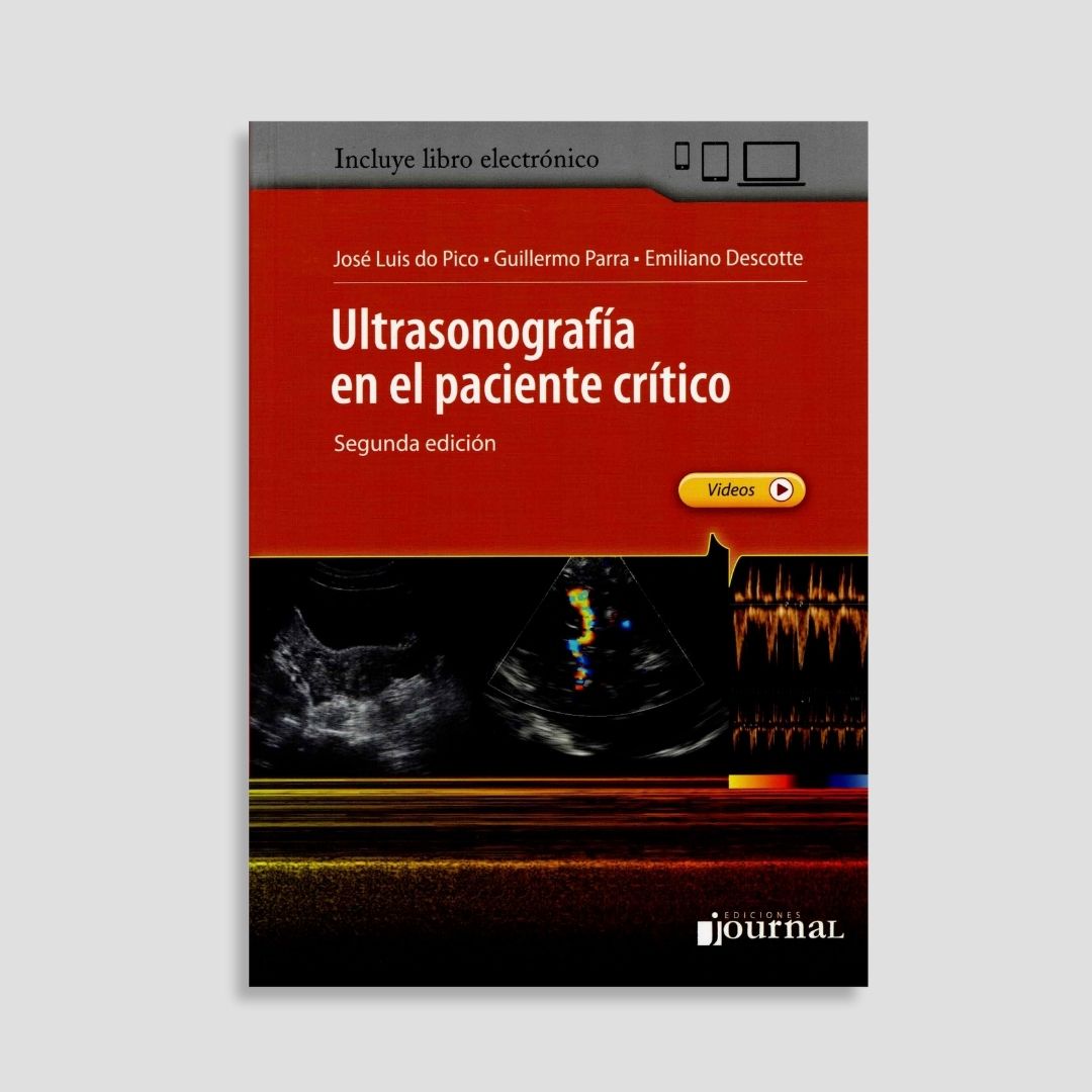 Ultrasonografía en el Paciente Crítico