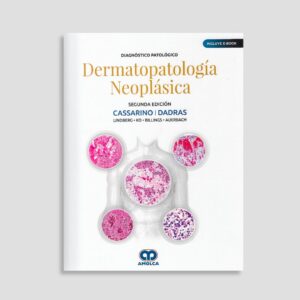 Diagnóstico Patológico Dermatopatología Neoplásica