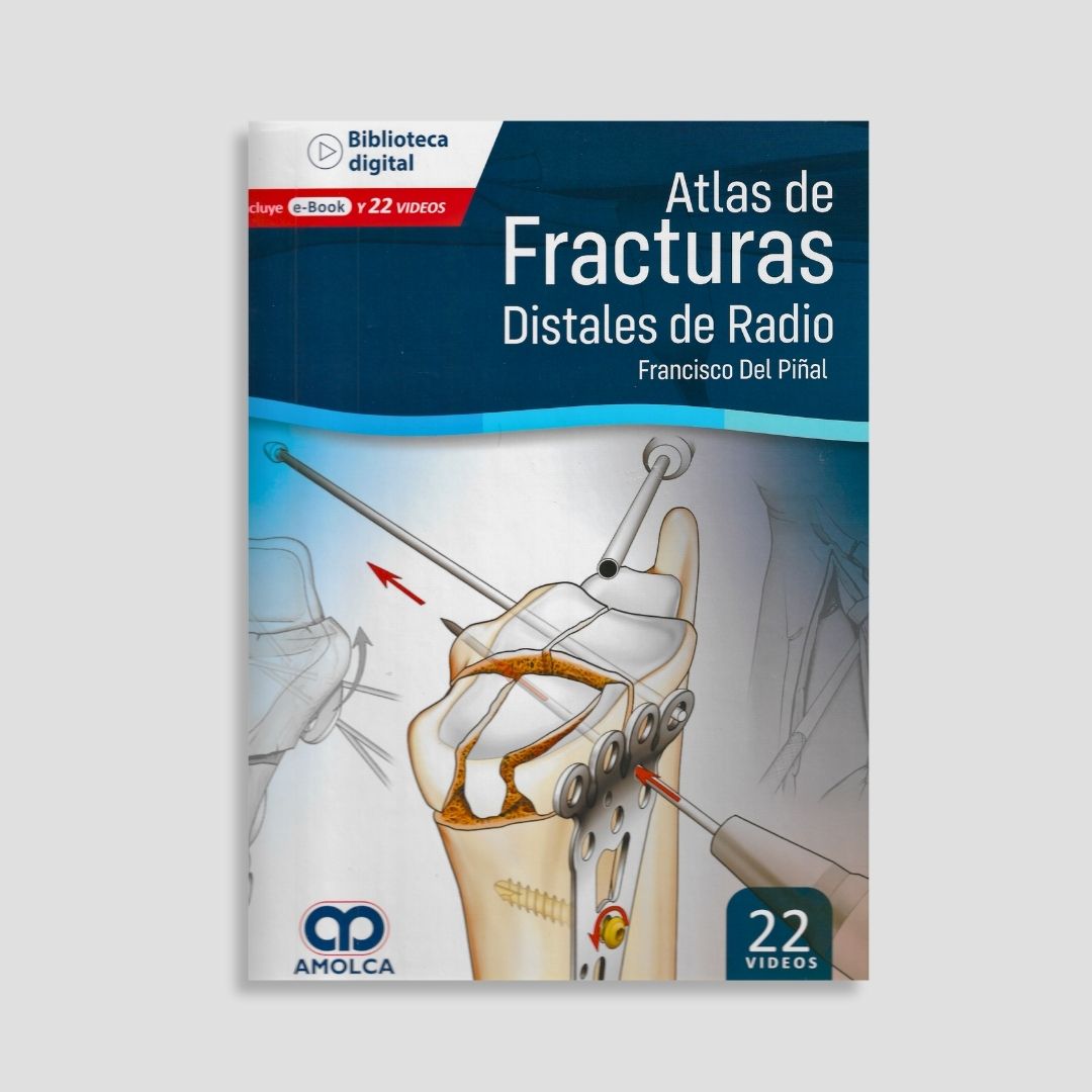 Atlas de Fracturas Distales de Radio