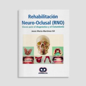 Rehabilitación Neuro-Oclusal (RNO)