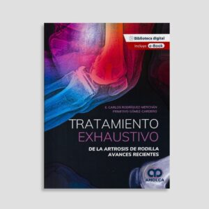 Tratamiento exhaustivo de la artrosis de rodilla