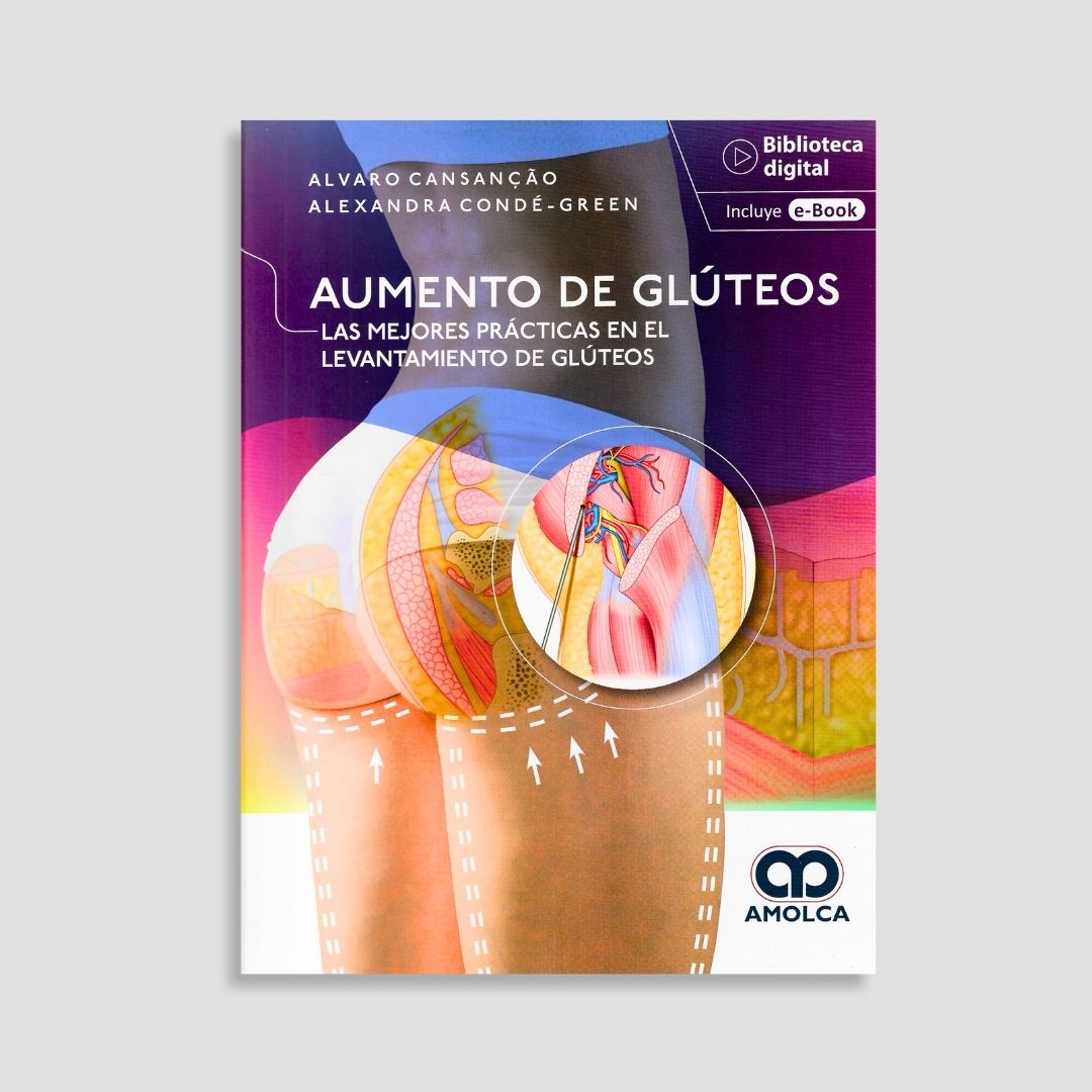 Aumento de glúteos. Las mejores prácticas en el levantamiento de glúteos
