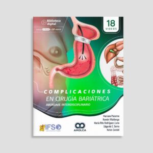 Complicaciones en Cirugía Bariátrica