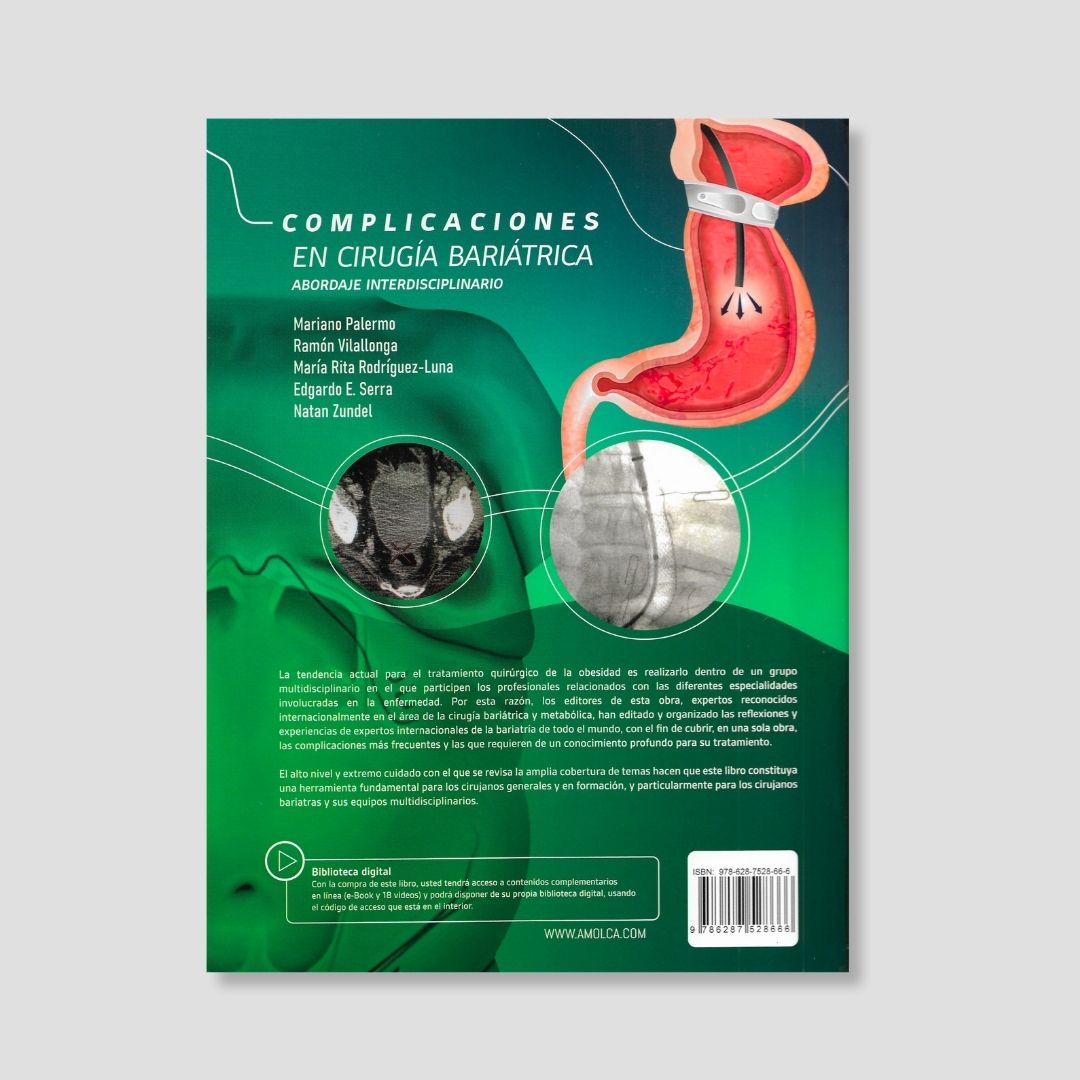 Complicaciones en Cirugía Bariátrica - Image 2