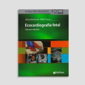 Ecocardiografía Fetal