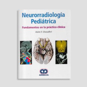 Neurorradiología Pediátrica