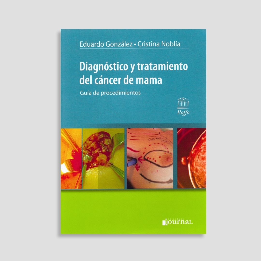 Diagnóstico y Tratamiento del Cáncer de Mama