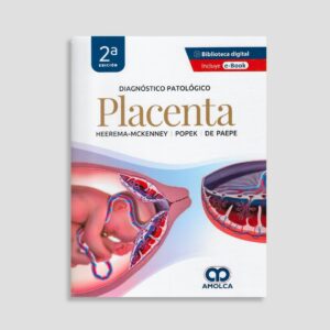 Diagnóstico patológico: Placenta