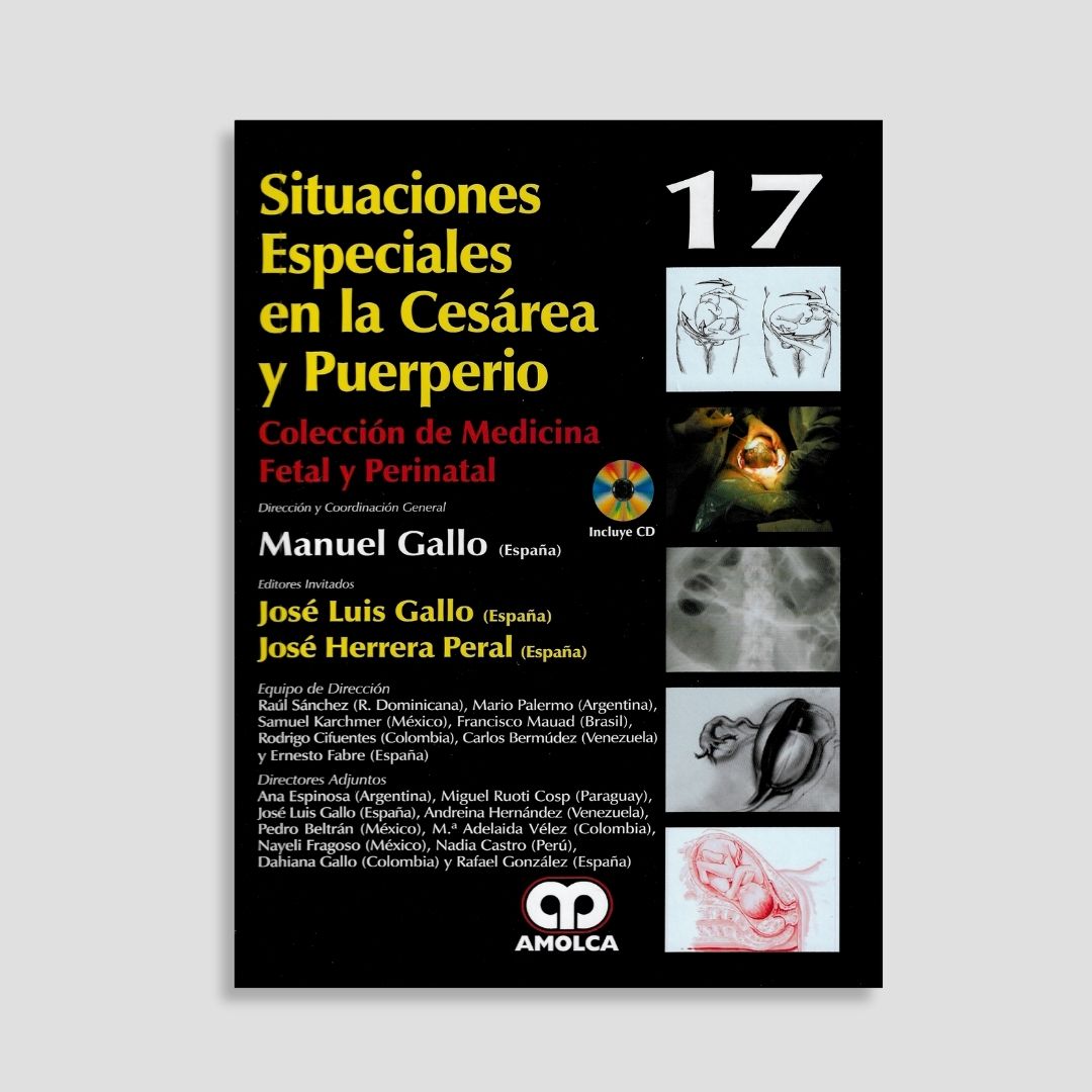 Situaciones Especiales en la Cesárea y Puerperio