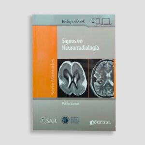Signos en Neurorradiología