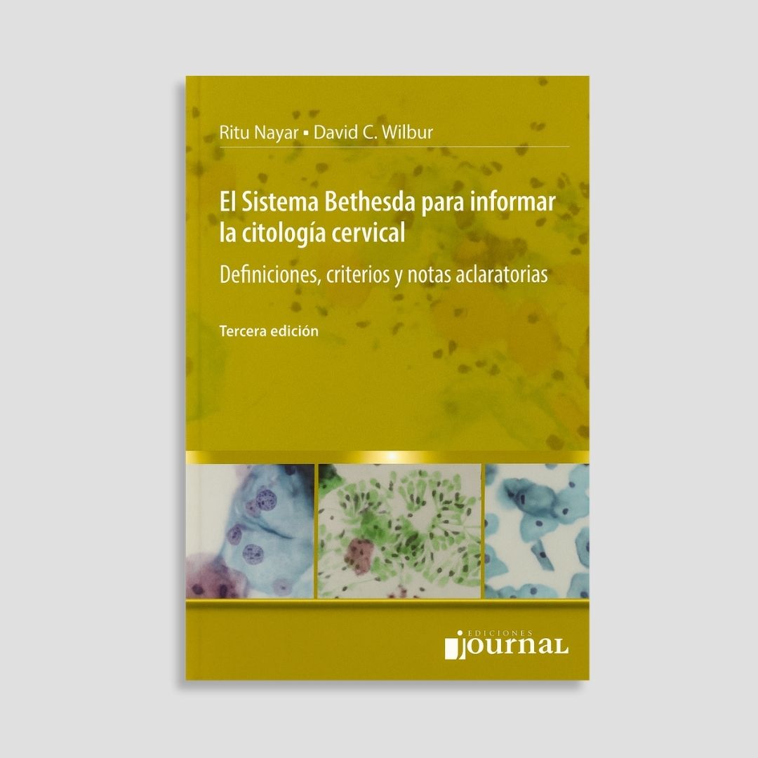El Sistema Bethesda para informar la Citología Cervical